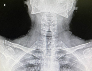 Click on image to zoom