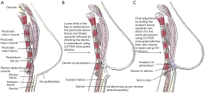 Click on image to zoom