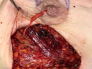 Click on image to zoom
