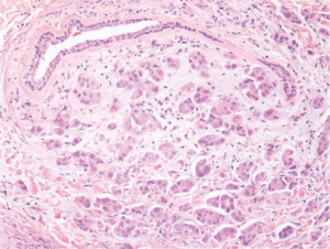 Click on image to zoom