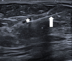 Click on image to zoom