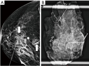 Click on image to zoom