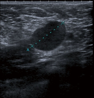 Click on image to zoom