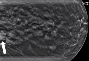 Click on image to zoom