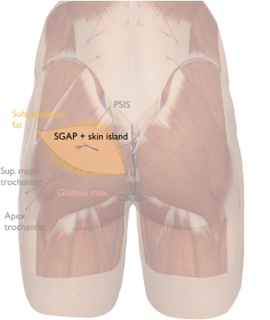 Click on image to zoom