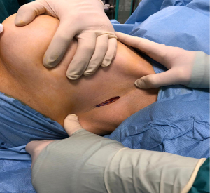 Click on image to zoom