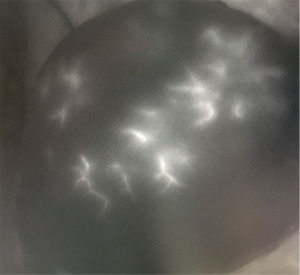 Click on image to zoom