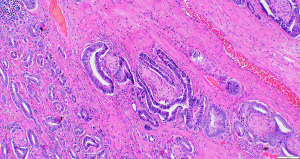 Click on image to zoom