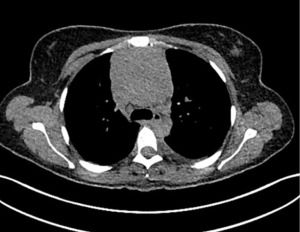 Click on image to zoom