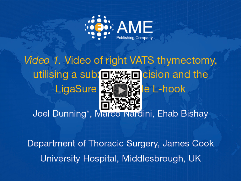 Right VATS thymectomy, utilising a subxiphoid incision and the LigaSure
