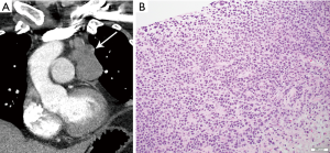 Click on image to zoom