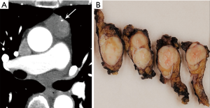 Click on image to zoom