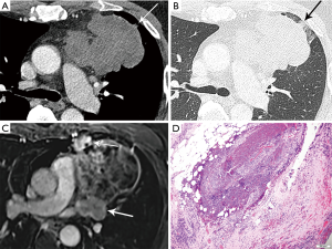 Click on image to zoom