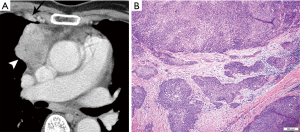 Click on image to zoom