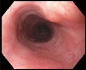 Click on image to zoom