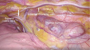 Click on image to zoom