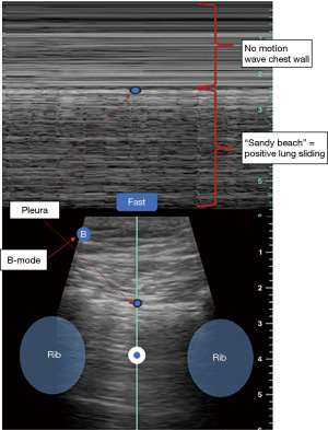 Click on image to zoom