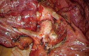 Click on image to zoom