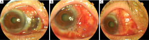 Click on image to zoom