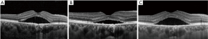 Click on image to zoom