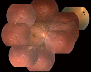 Click on image to zoom