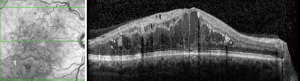 Click on image to zoom