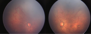 Click on image to zoom