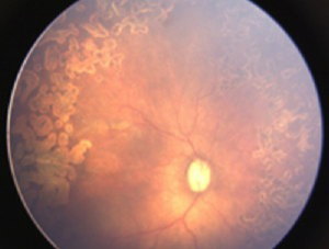 Click on image to zoom