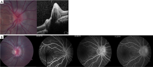 figure2