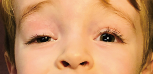 Click on image to zoom
