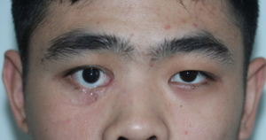 Click on image to zoom