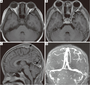 figure2