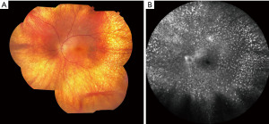 figure3