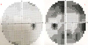 Click on image to zoom