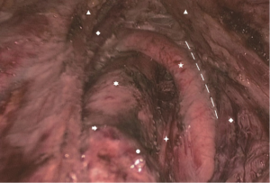 Click on image to zoom