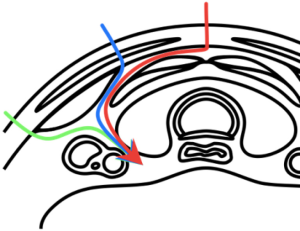 Click on image to zoom