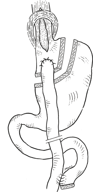 Click on image to zoom