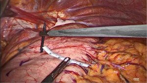 Click on image to zoom