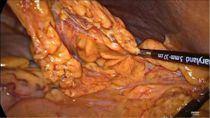 Click on image to zoom