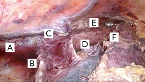 Click on image to zoom