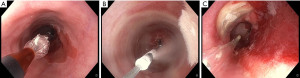 Click on image to zoom