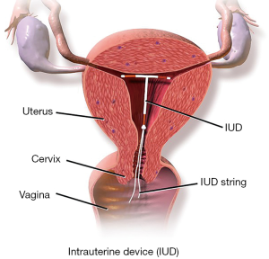 Click on image to zoom