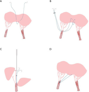 Click on image to zoom