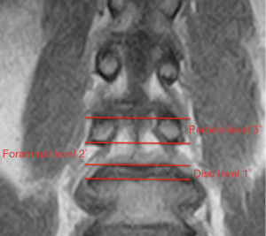 Click on image to zoom