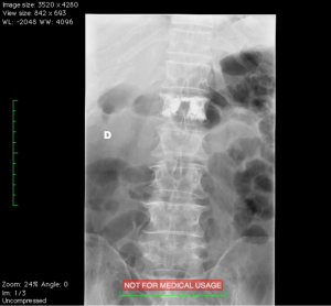 Click on image to zoom