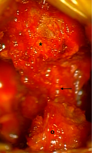 Click on image to zoom