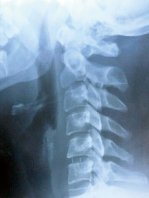 Click on image to zoom
