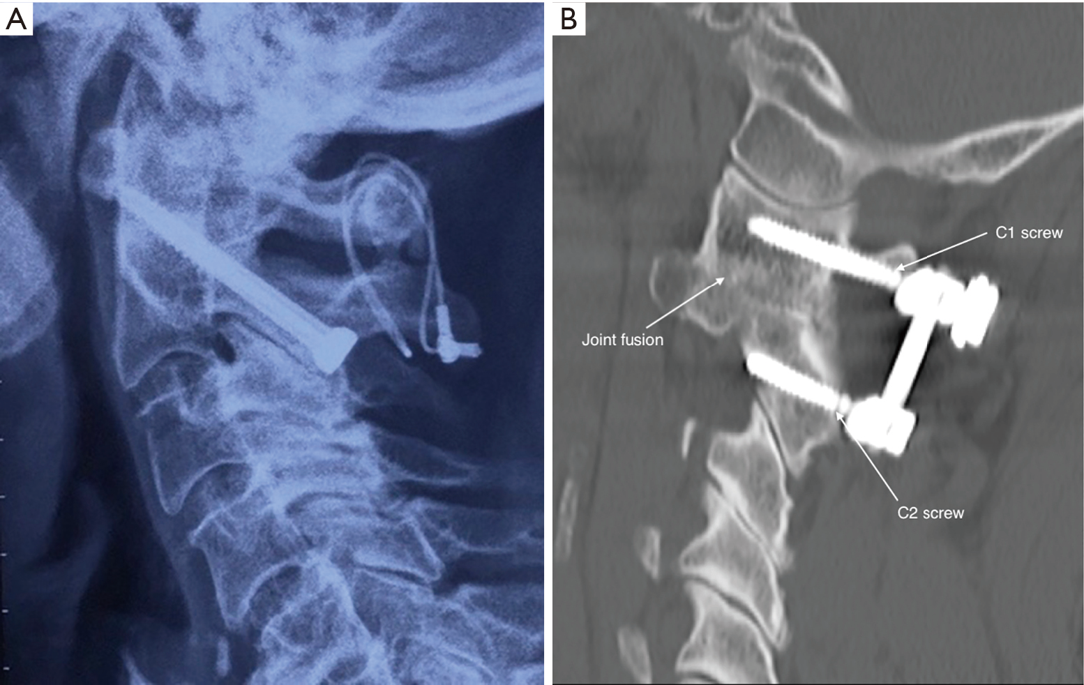 Clinical and radiological of image guided
