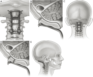 Click on image to zoom