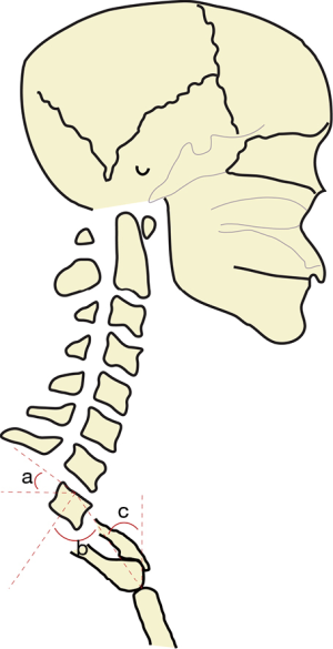 Click on image to zoom